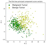 a Breast Cancer Analysis